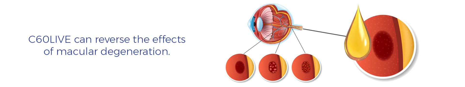 C60LIVE can reverse the effects of macular degeneration.
