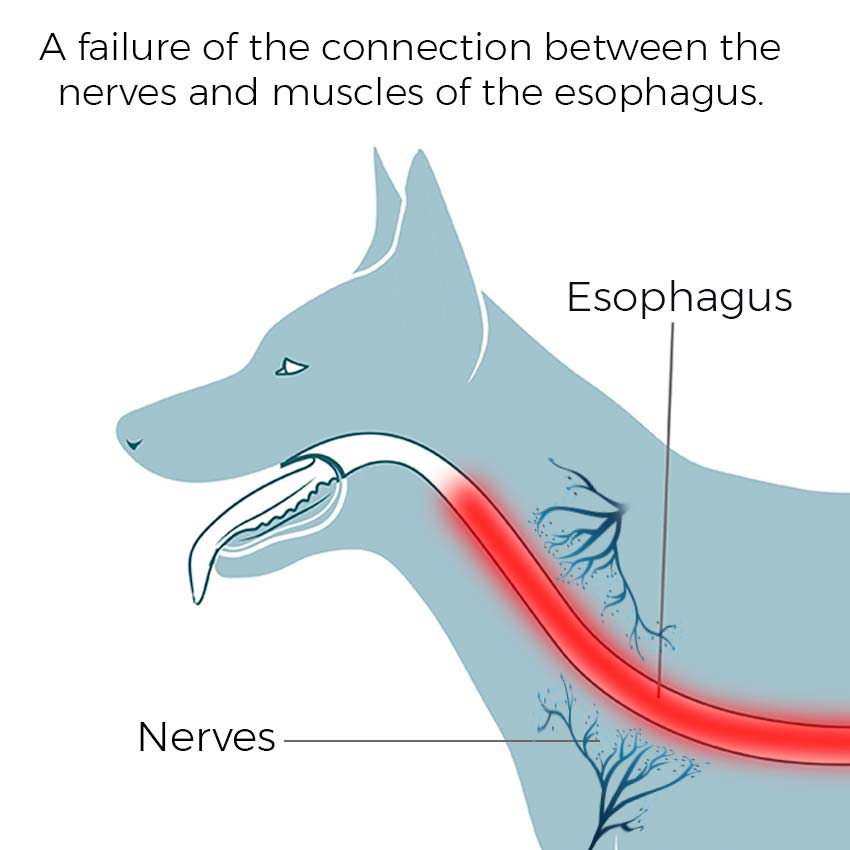 A failure of the connection between the nerves and muscles of the esophagus.