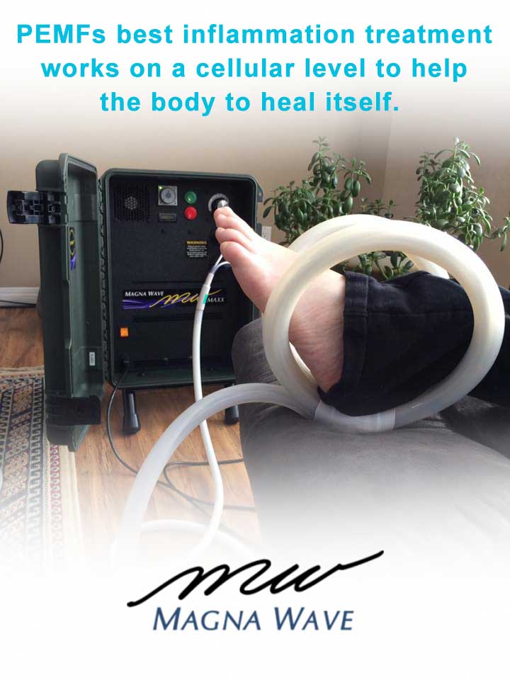 PEMFs best inflammation treatment works on a cellular level to help the body to heal itself.