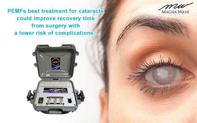 PEMFs best treatment for cataracts could improve recovery time from surgery with a lower risk of complications.