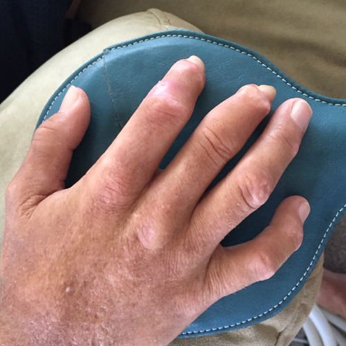 MAGNA WAVE PEMF DEVICES FOR RHEUMATOID ARTHRITIS