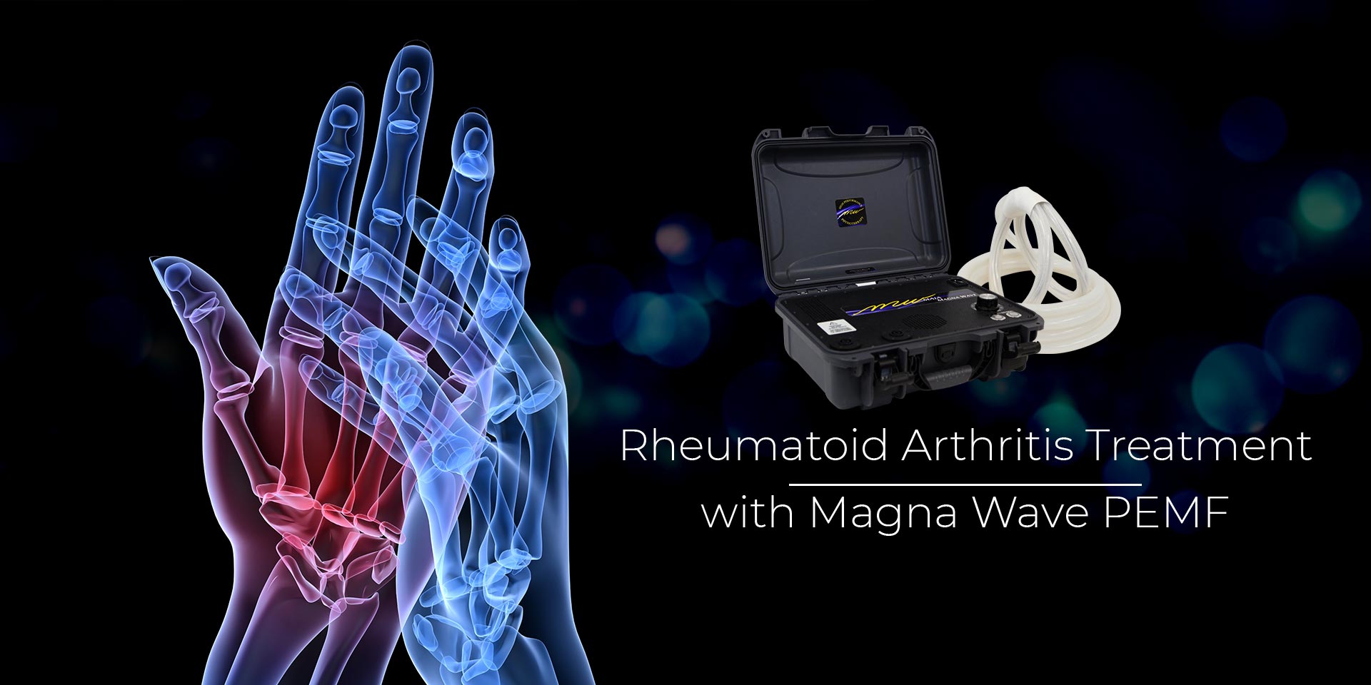 Rheumatoid Arthritis Treatment with Magna Wave PEMF