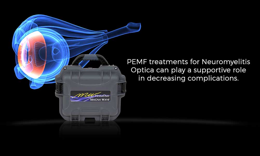 PEMF treatments for Neuromyelitis Optica can play a supportive role in decreasing complications