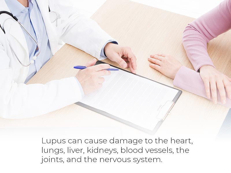 Lupus can cause damage to the heart, lungs, liver, kidneys, blood vessels, the joints, and the nervous system.