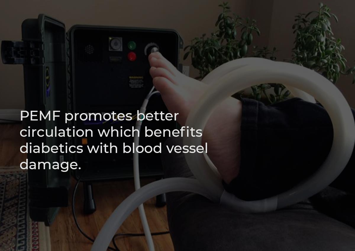 PEMF promotes better circulation which benefits diabetics with blood vessel damage